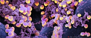Staphylococcus aureus