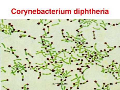 Bakteri Corynebacterium diphtheriae 